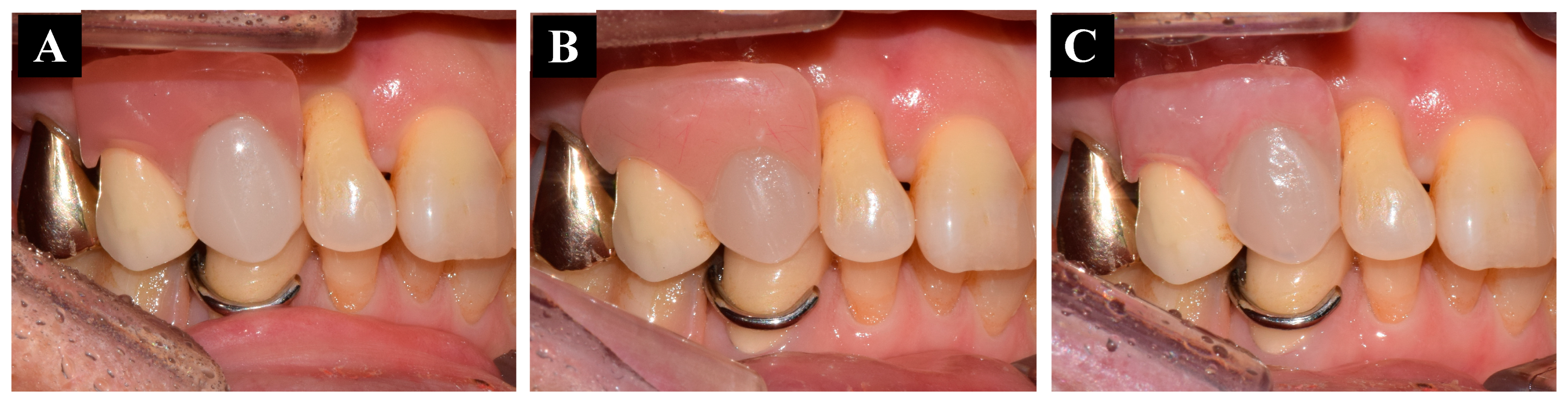 Applsci 14 02838 g007