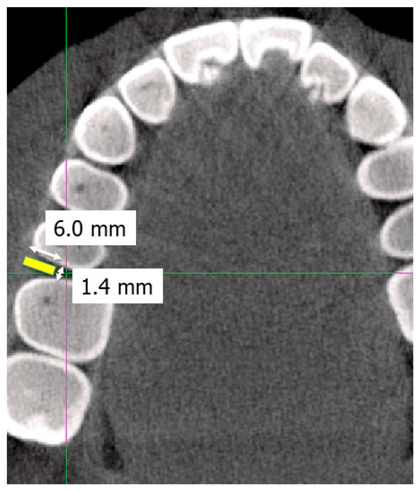 Applsci 14 03041 g002