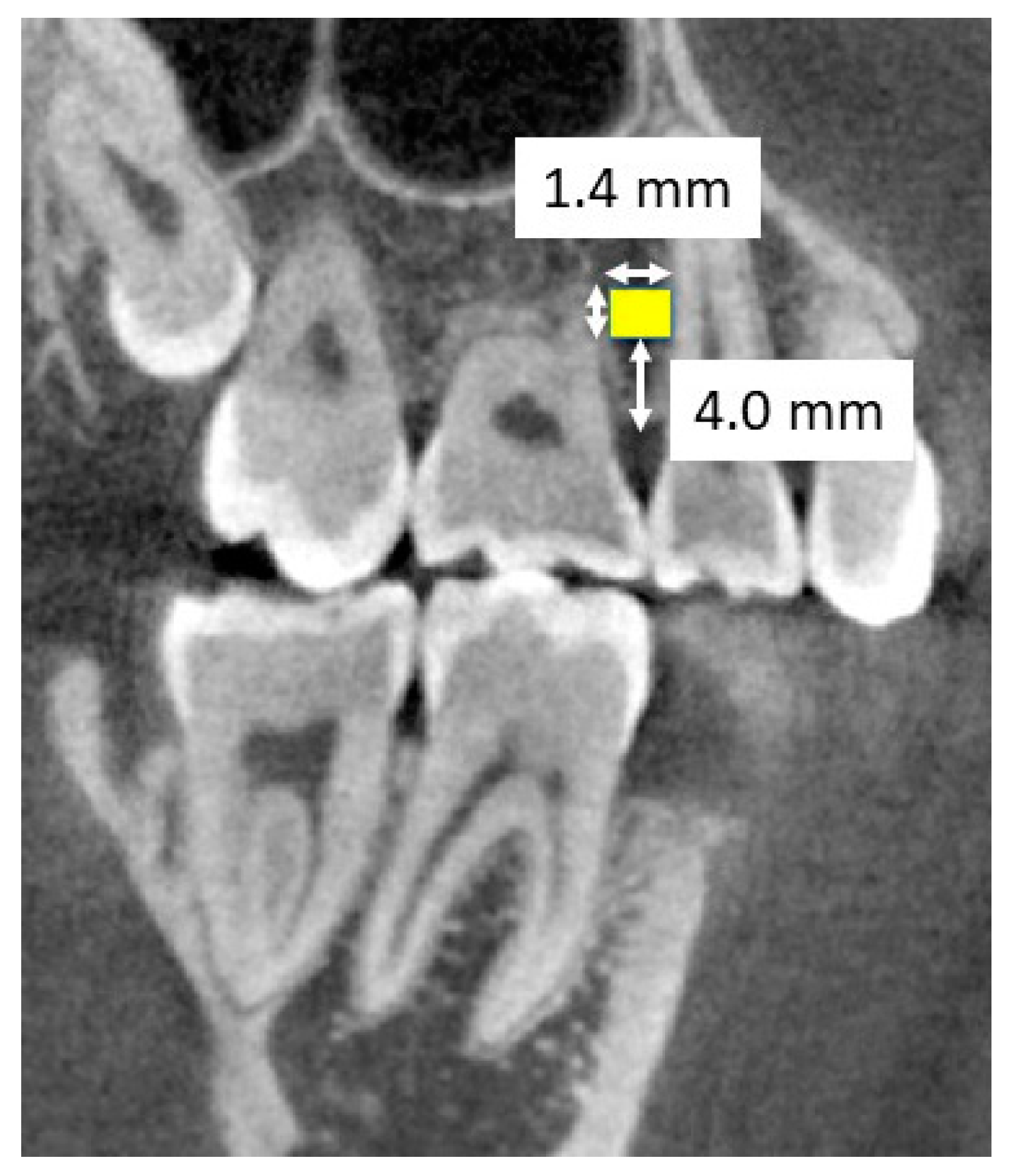 Applsci 14 03041 g003
