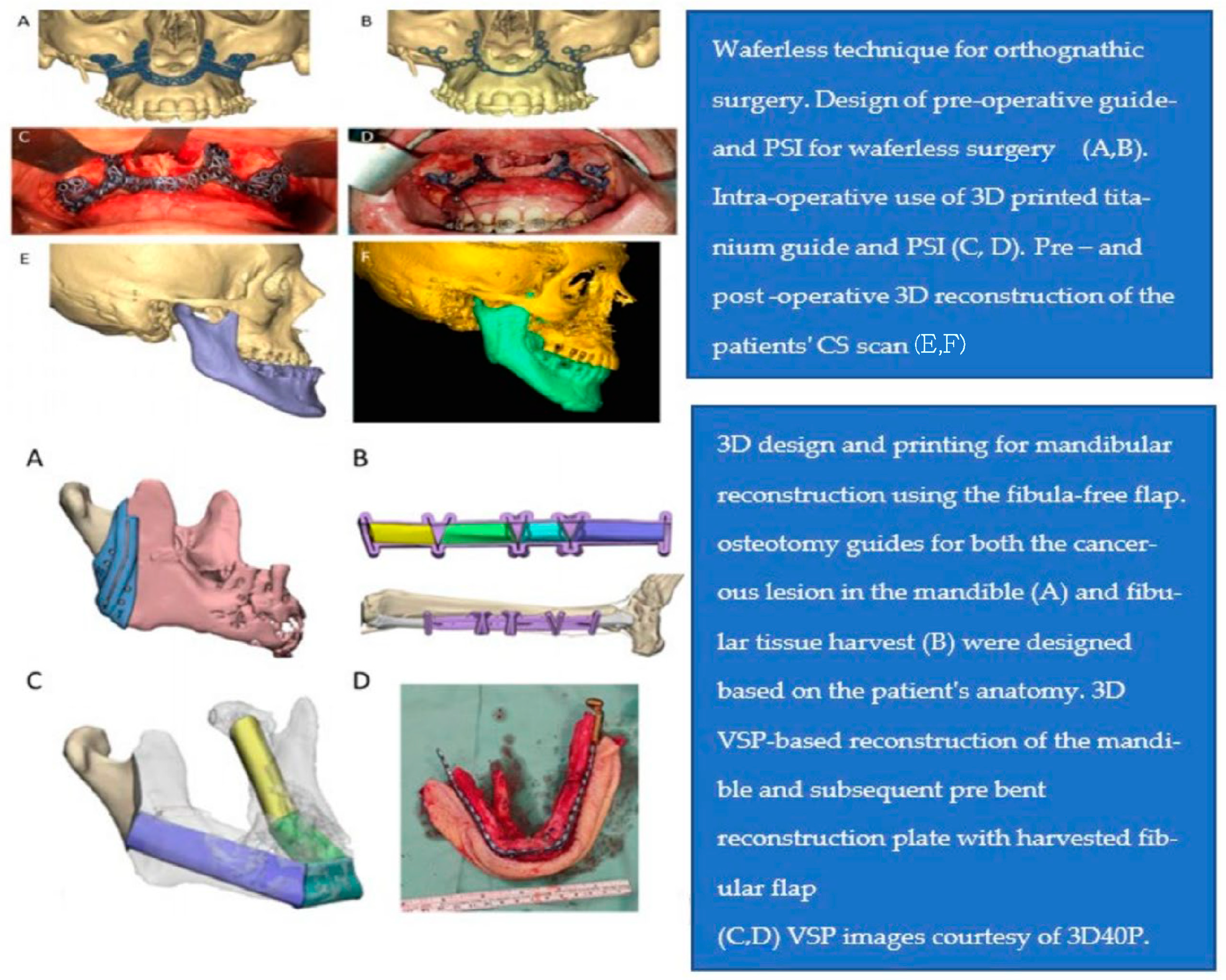 Applsci 14 03075 g005