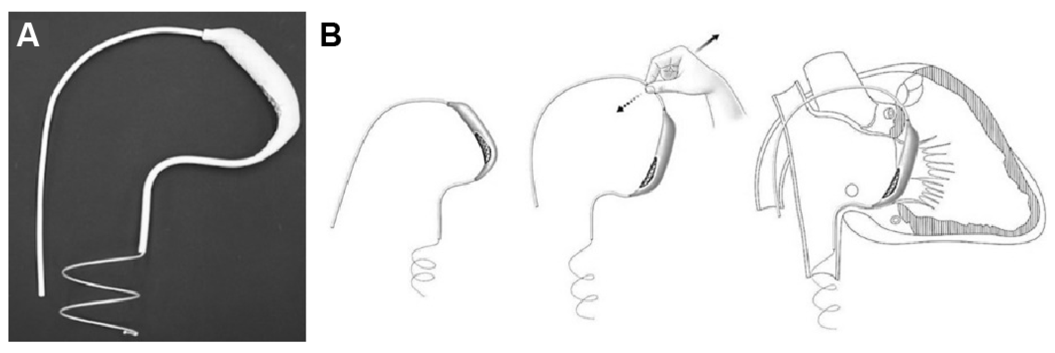 Applsci 14 03307 g001