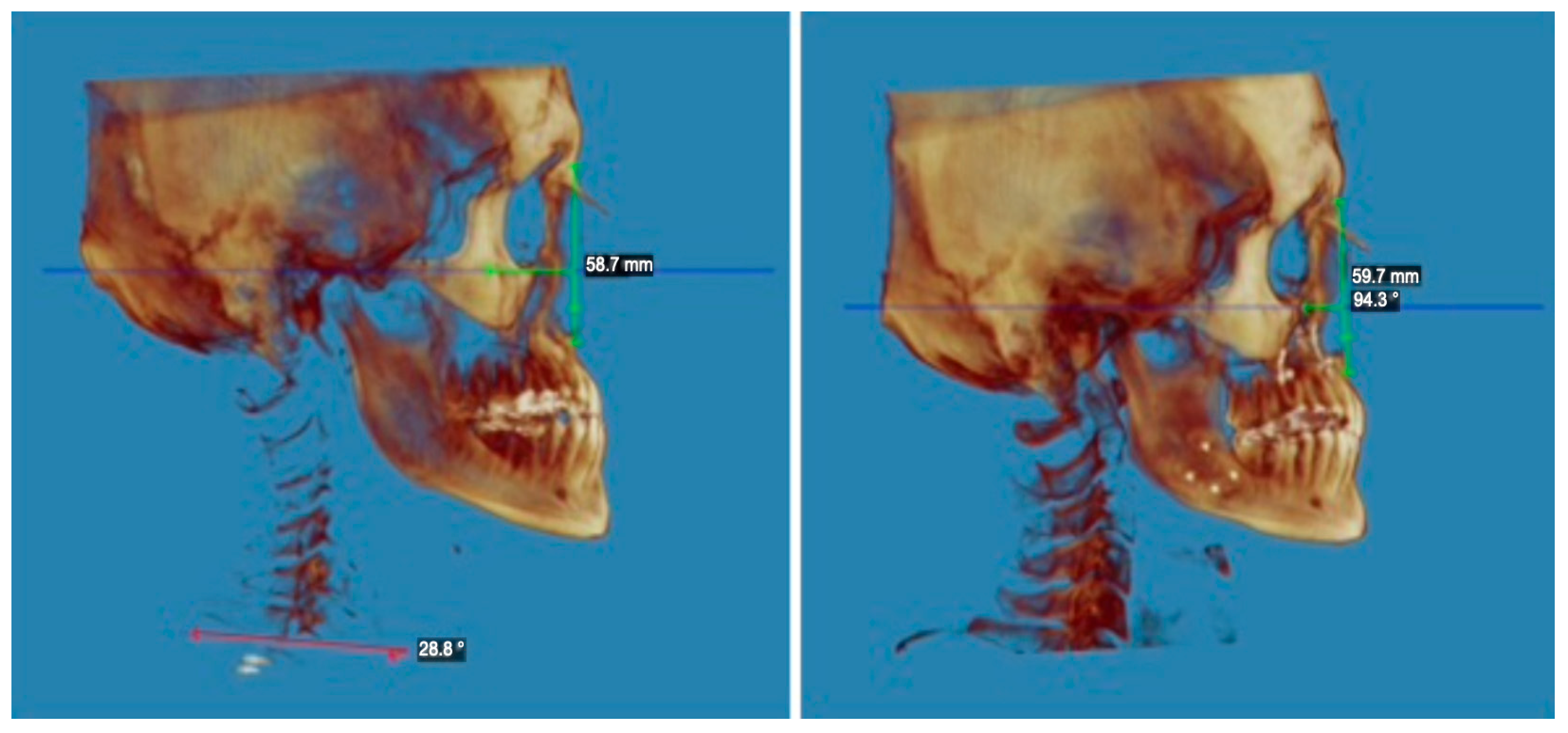 Applsci 14 03529 g002