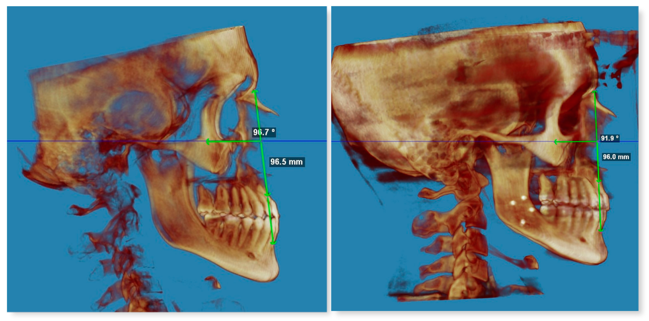 Applsci 14 03529 g003