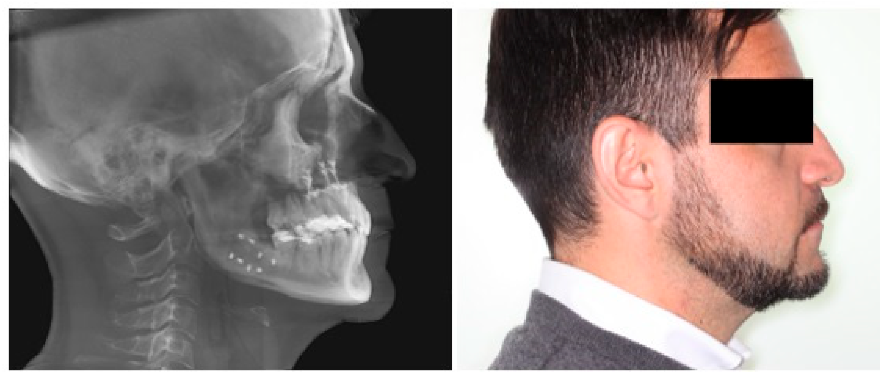 Applsci 14 03529 g006