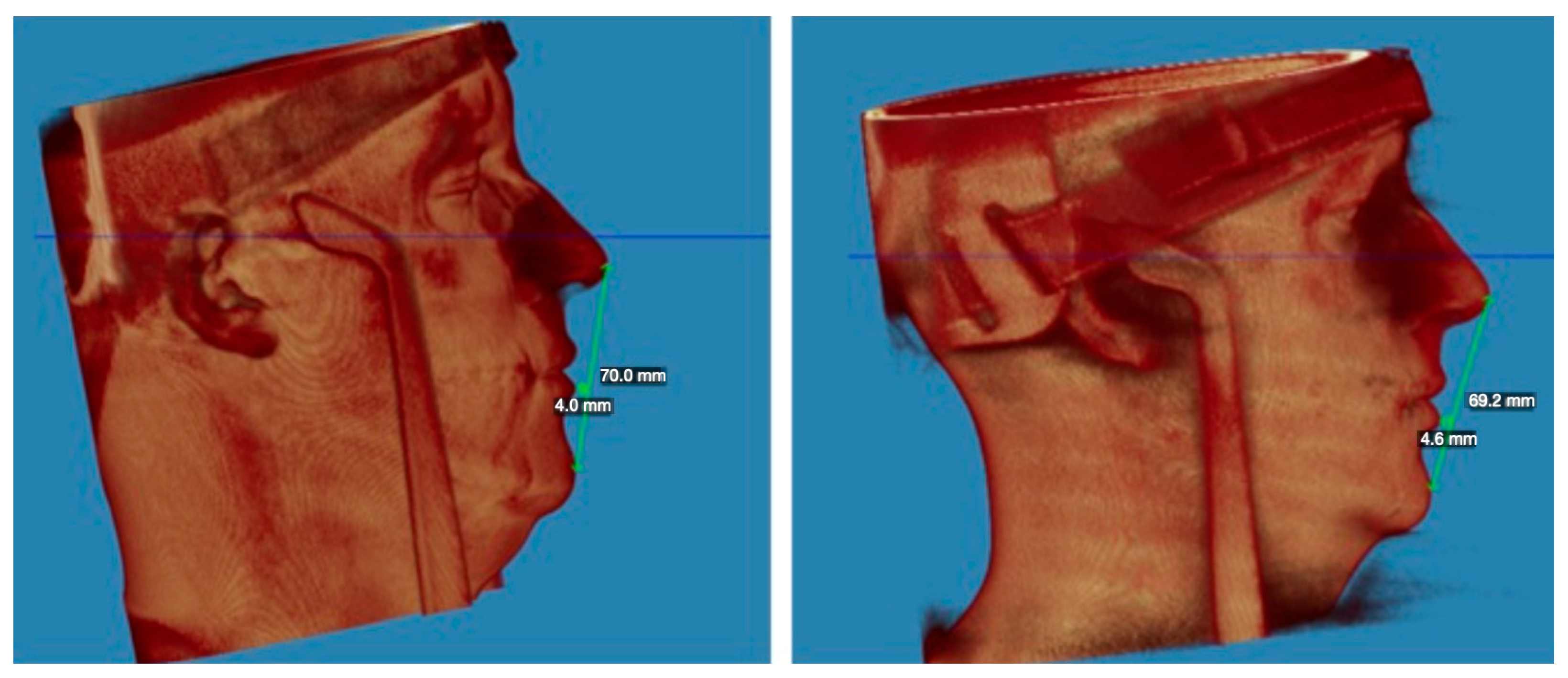 Applsci 14 03529 g007