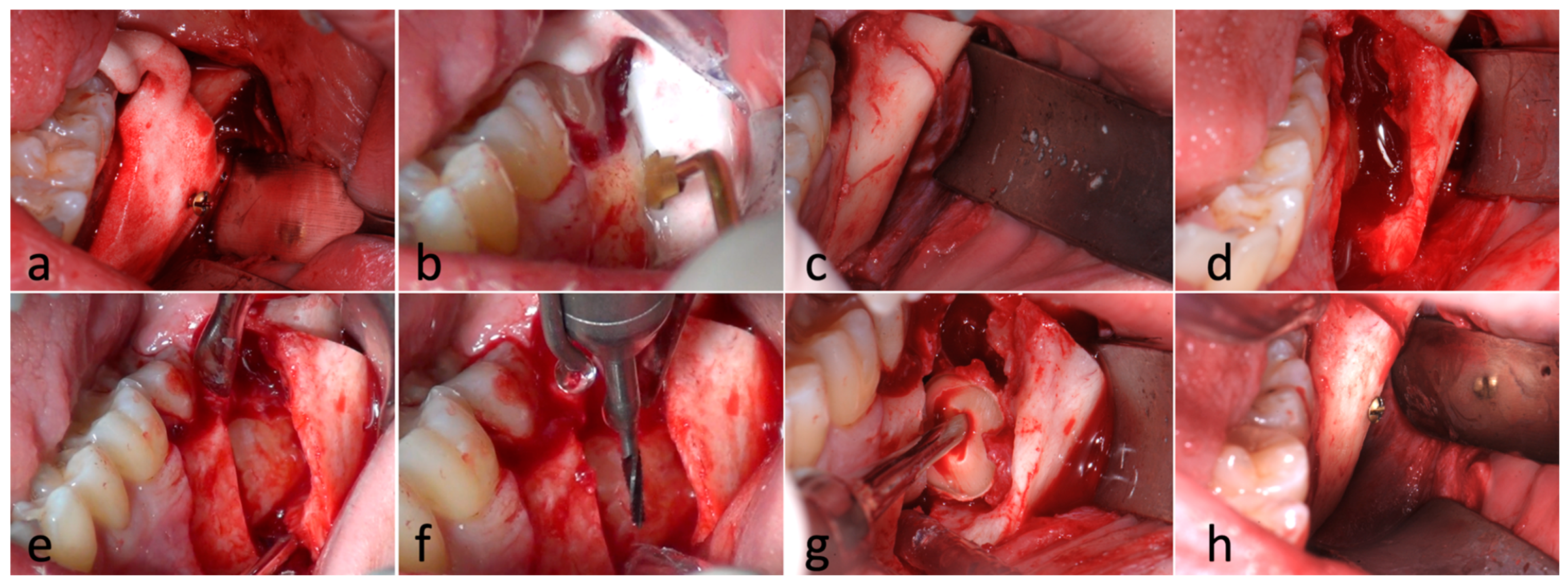 Applsci 14 03580 g004