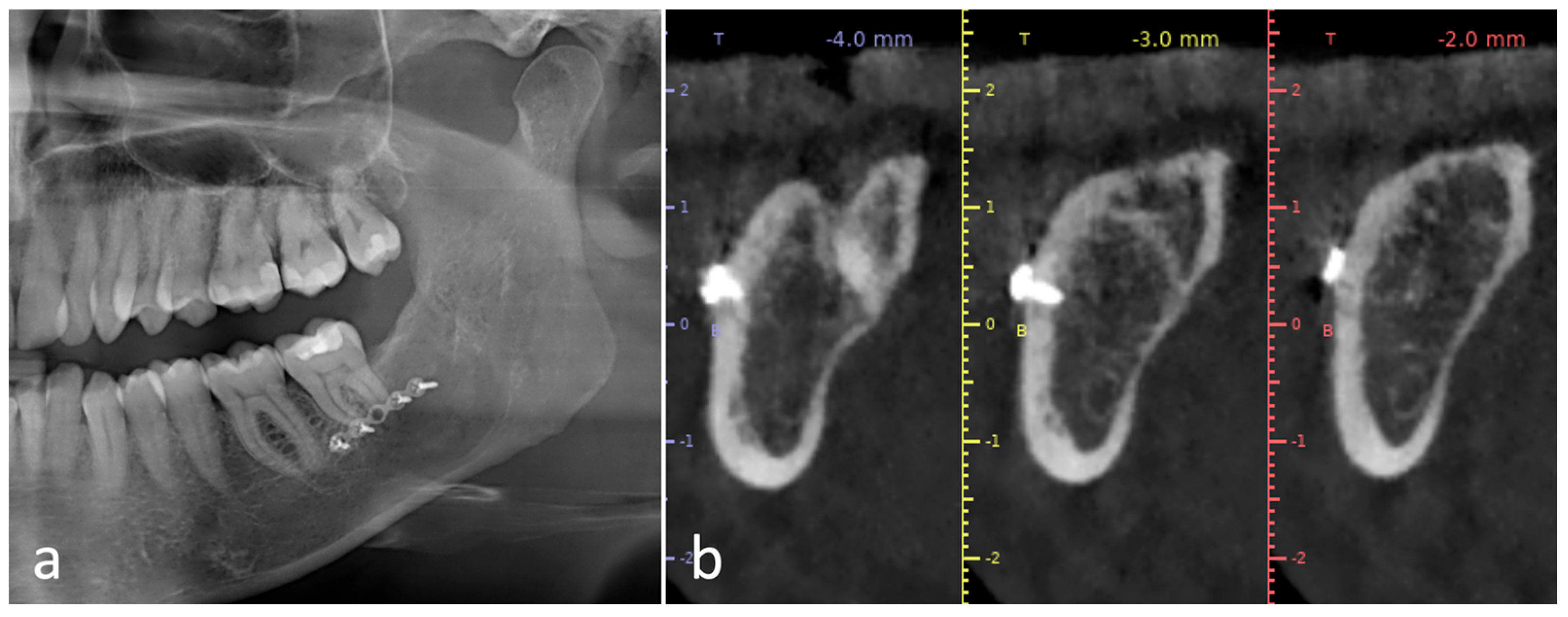 Applsci 14 03580 g005