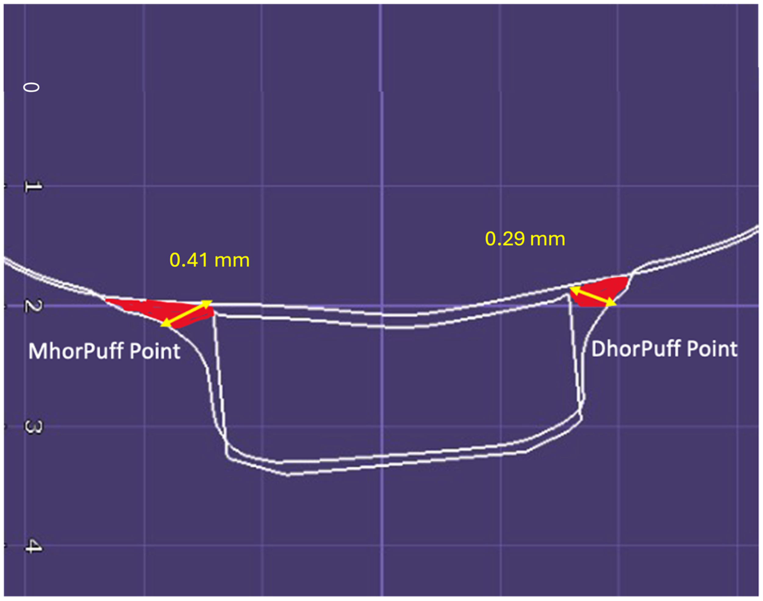 Applsci 14 03837 g008 Applsci 14 03837 g008