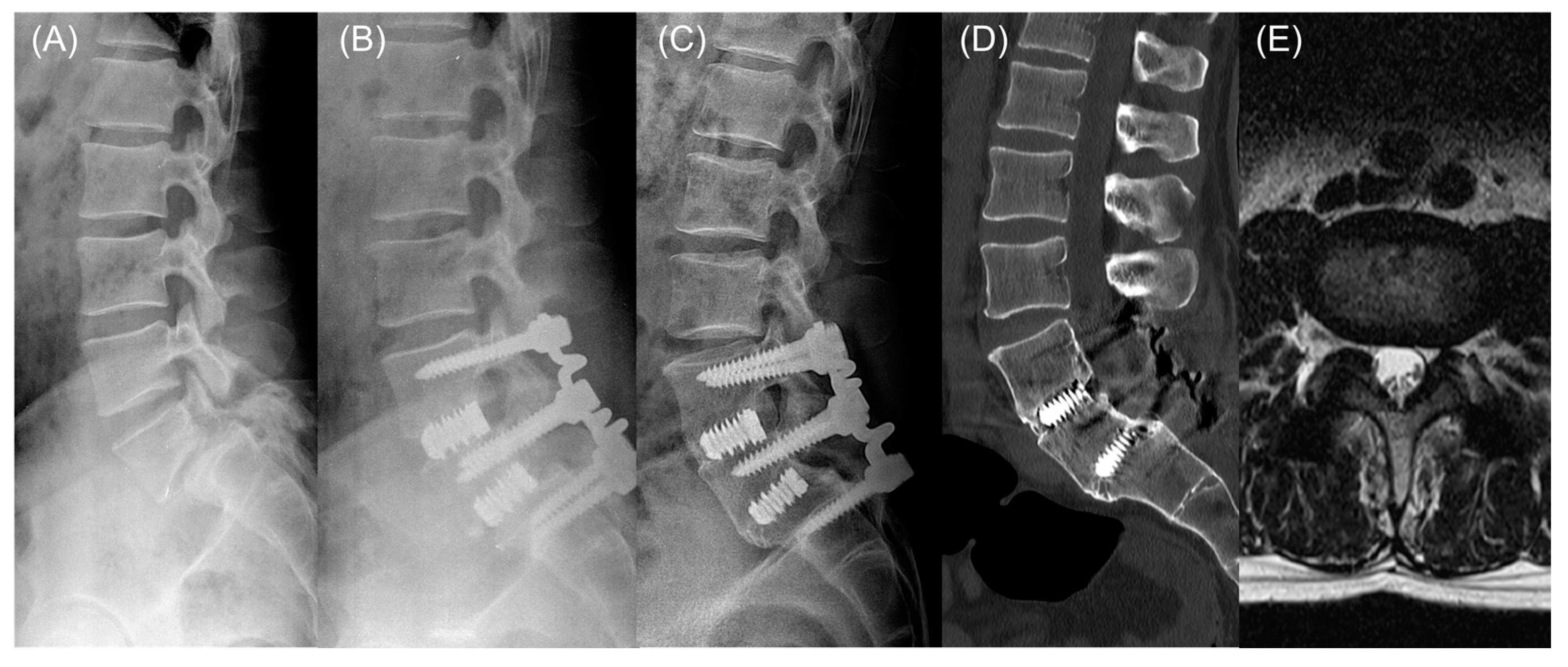 Applsci 14 04574 g003