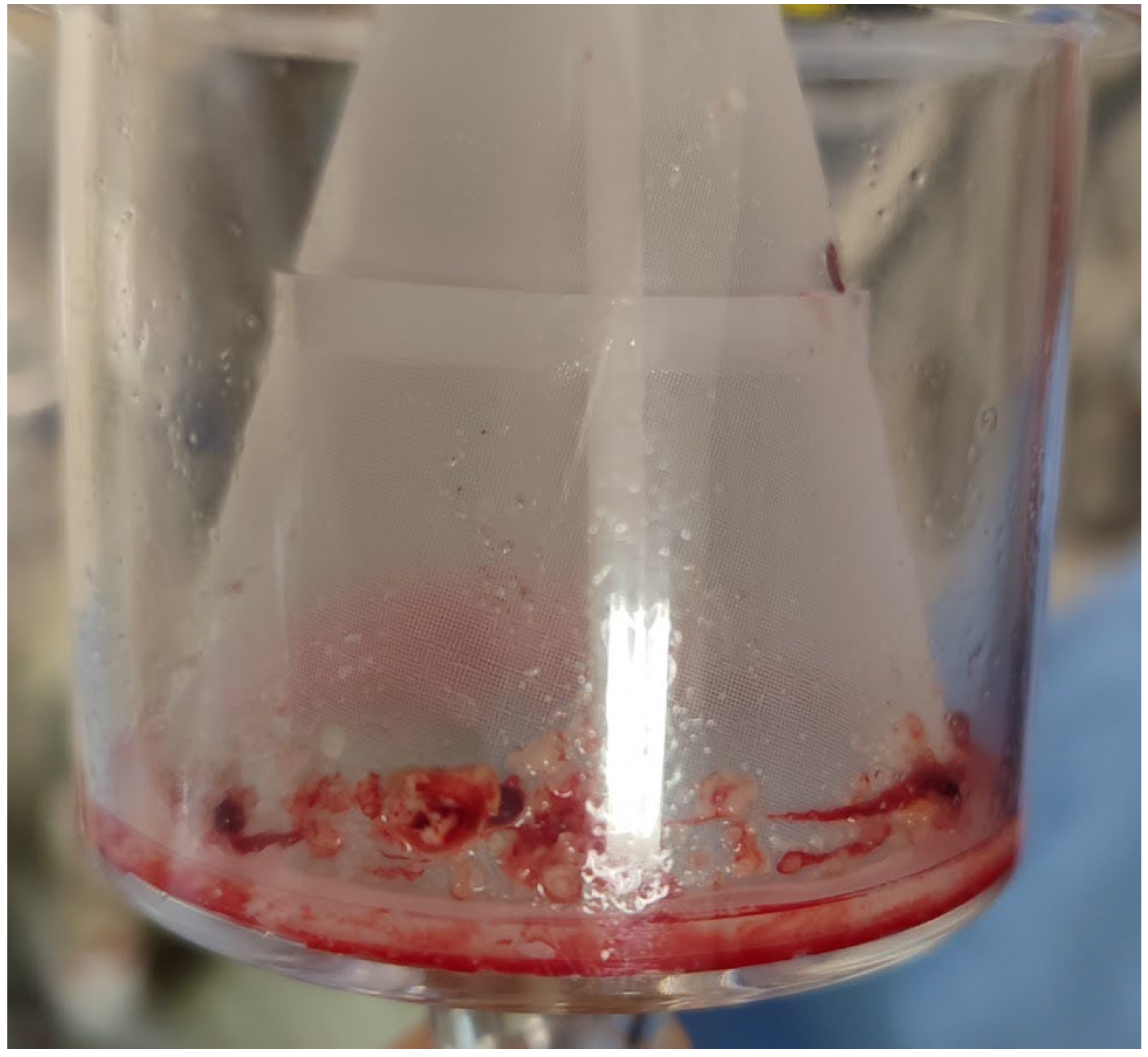 Applsci 14 04590 g006