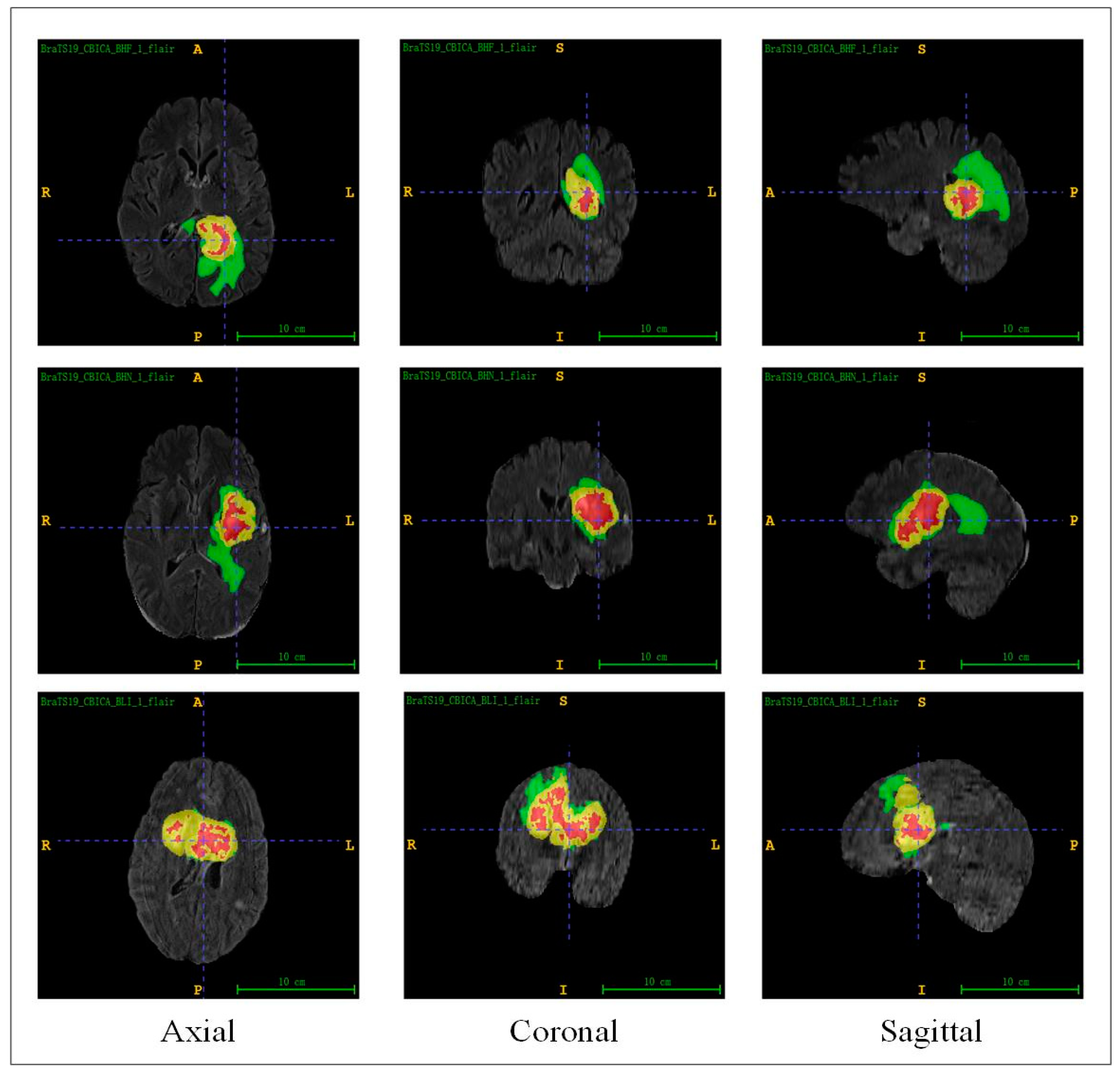 Applsci 14 04834 g004