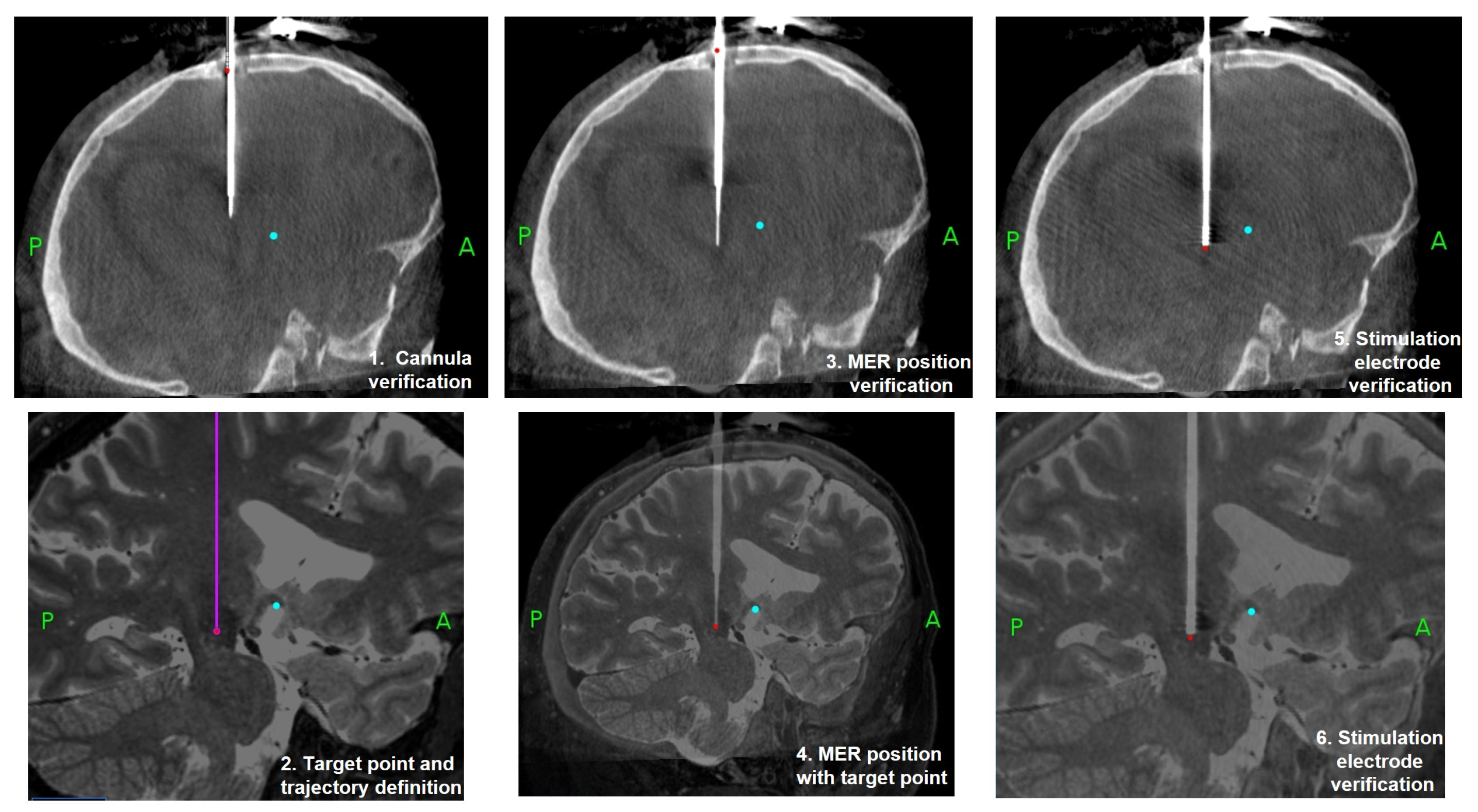 Applsci 14 05157 g001