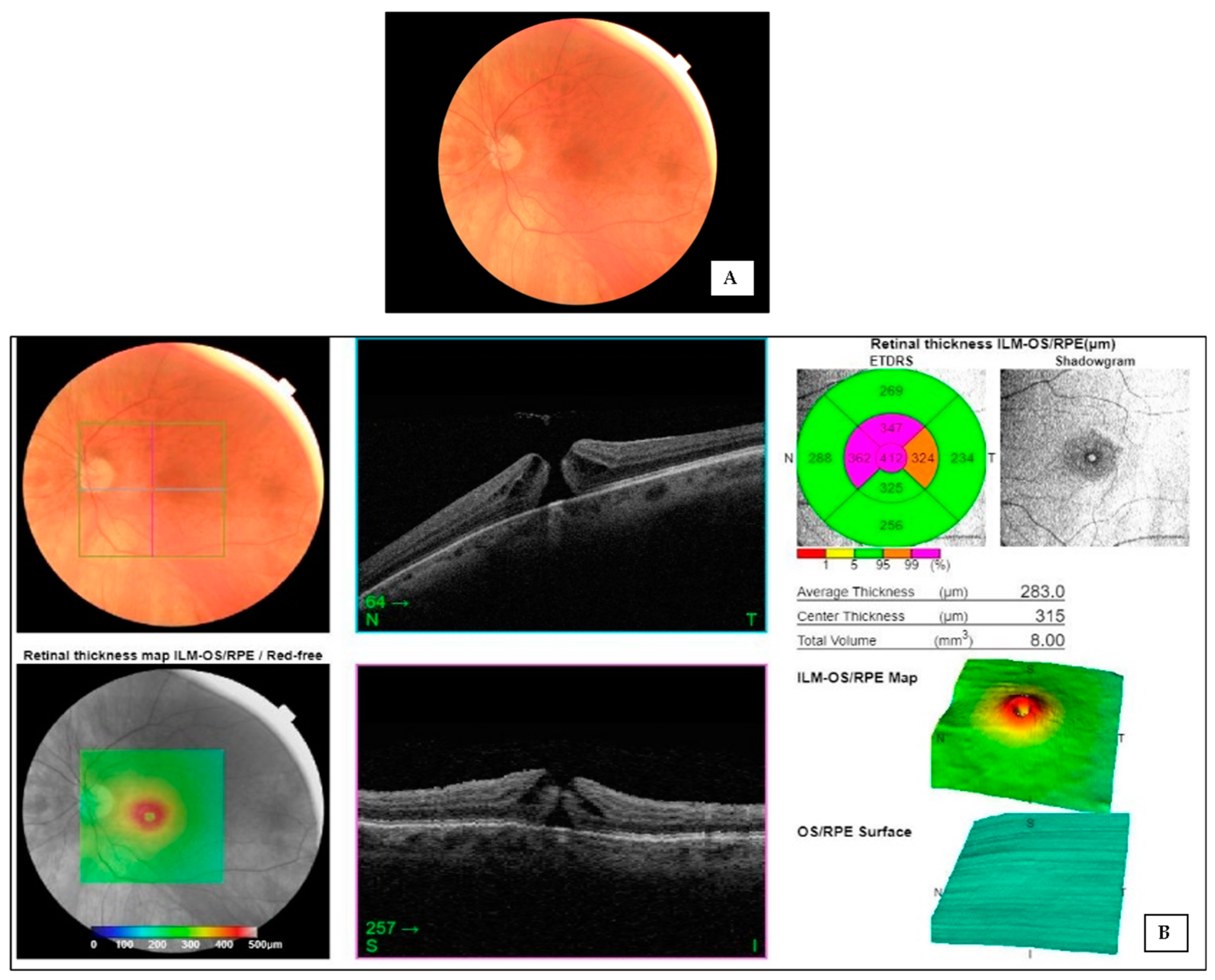 Applsci 14 05314 g007 Applsci 14 05314 g007