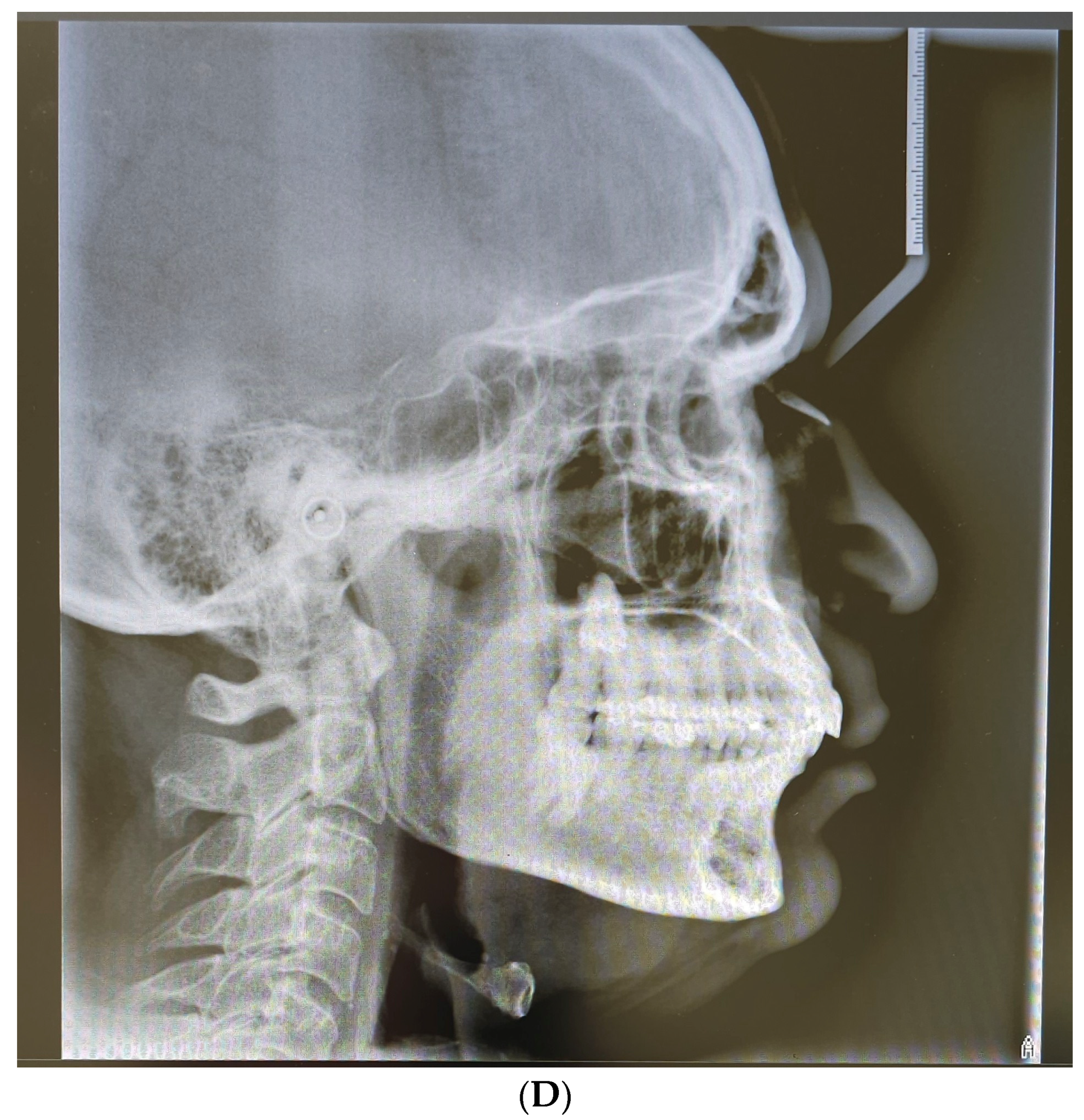 Applsci 14 05580 g001c