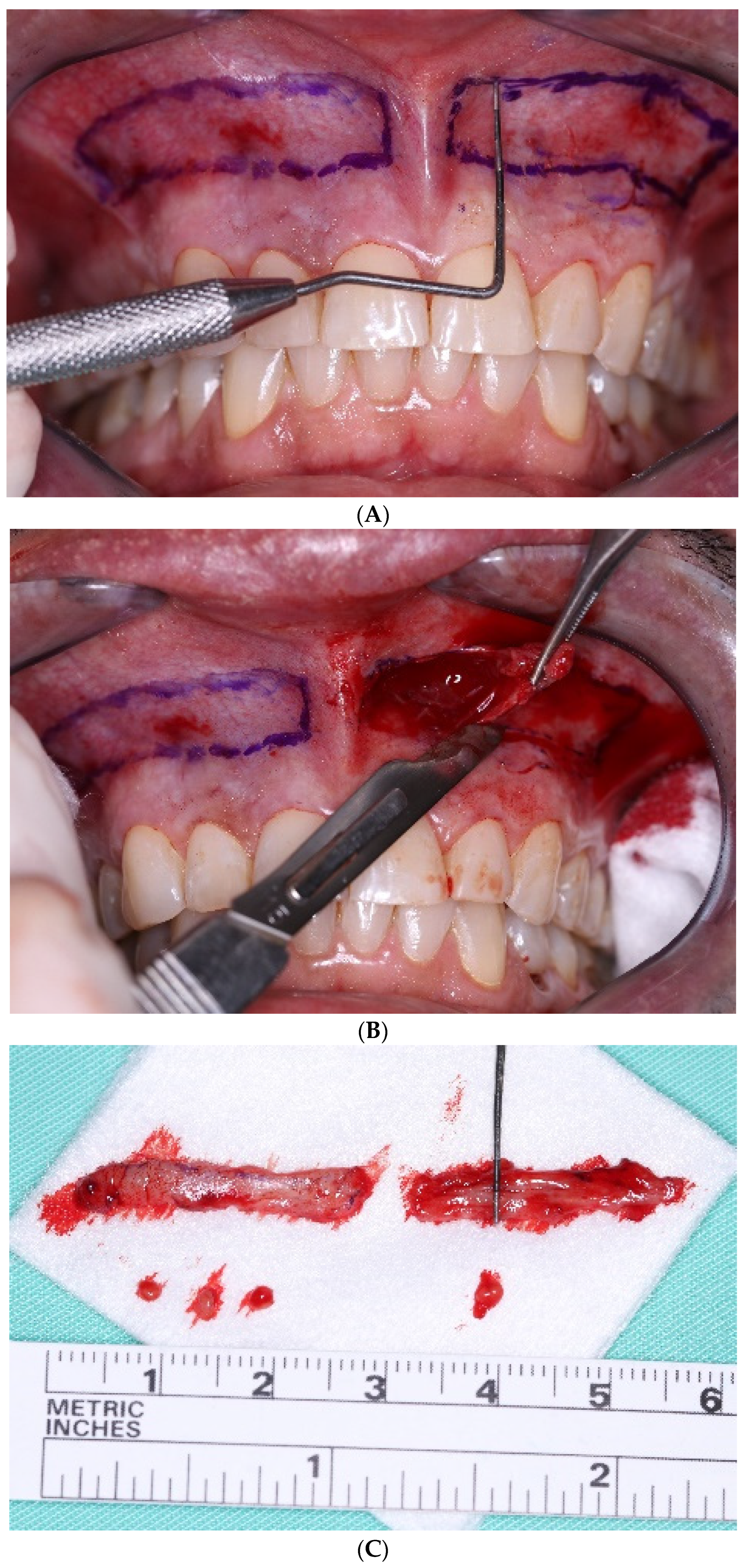 Applsci 14 05580 g002a
