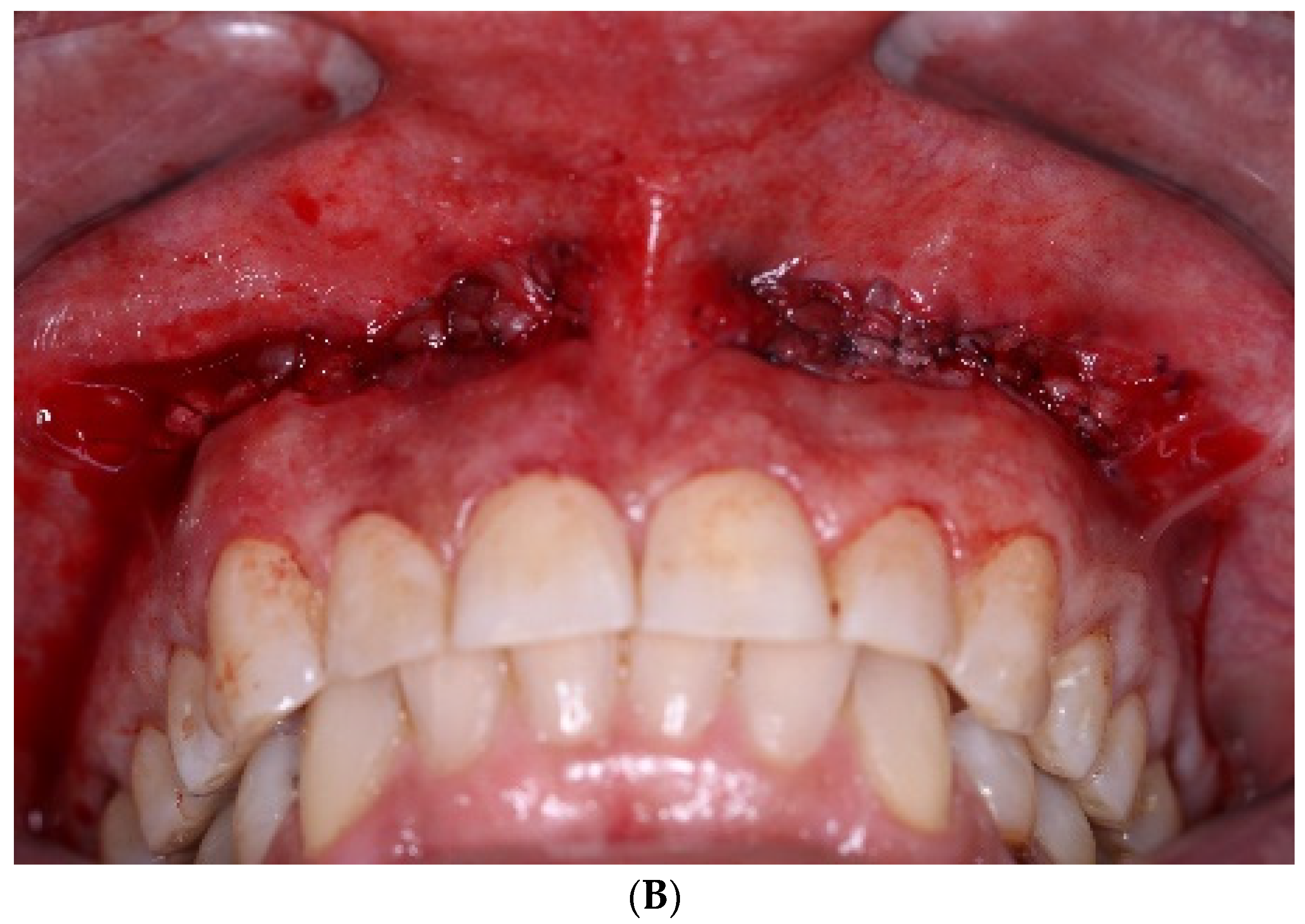 Applsci 14 05580 g003b