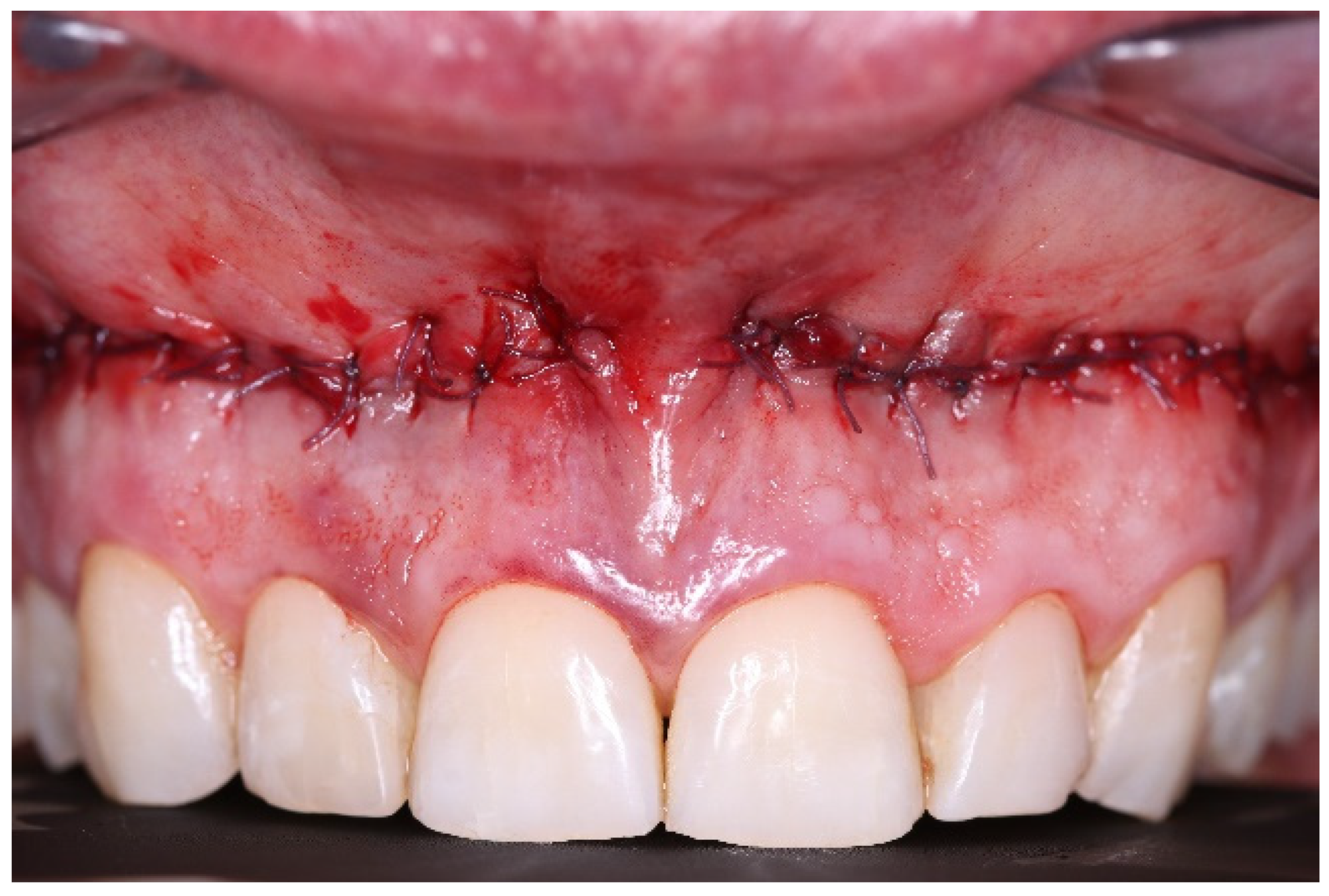 Applsci 14 05580 g004