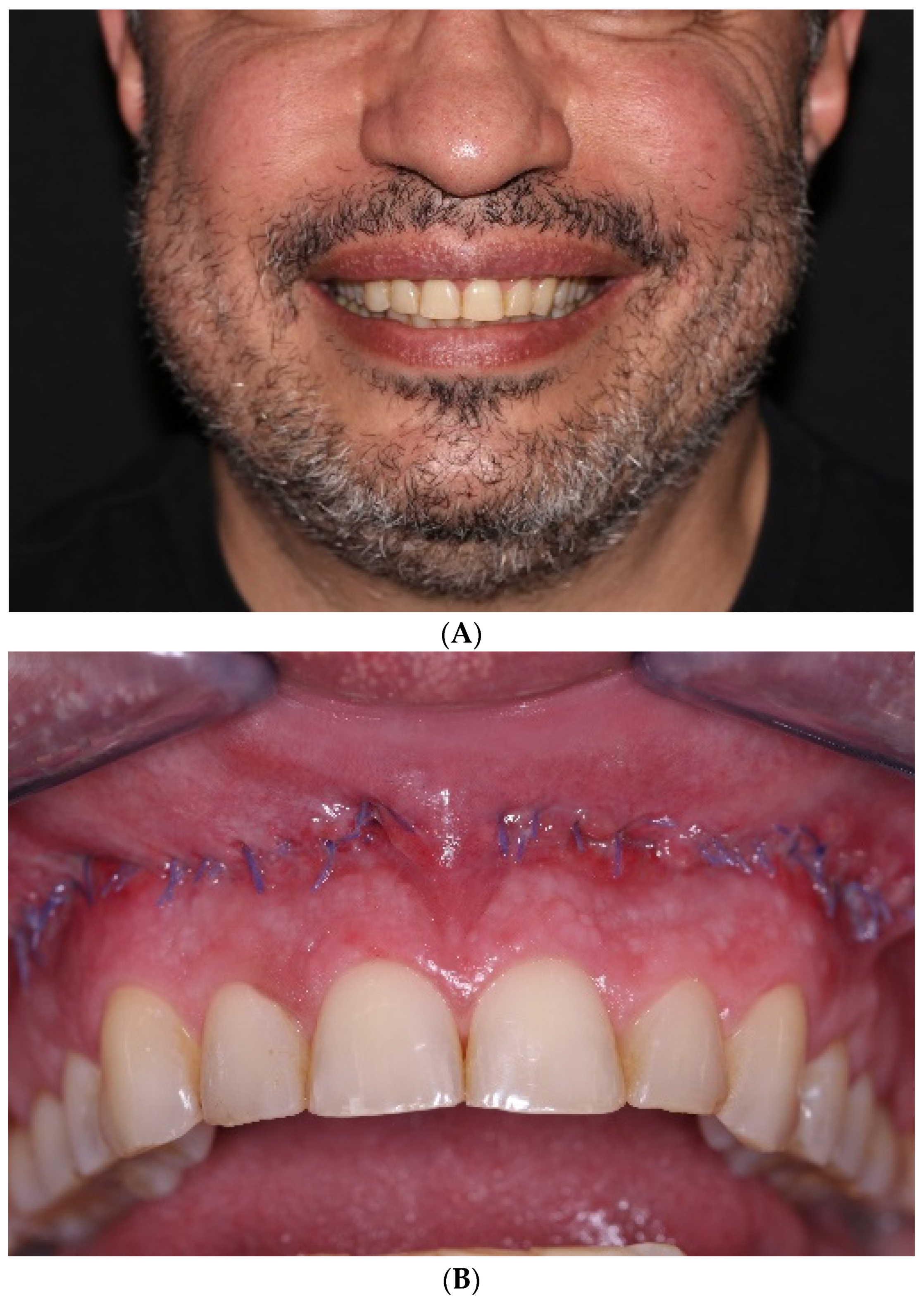 Applsci 14 05580 g005