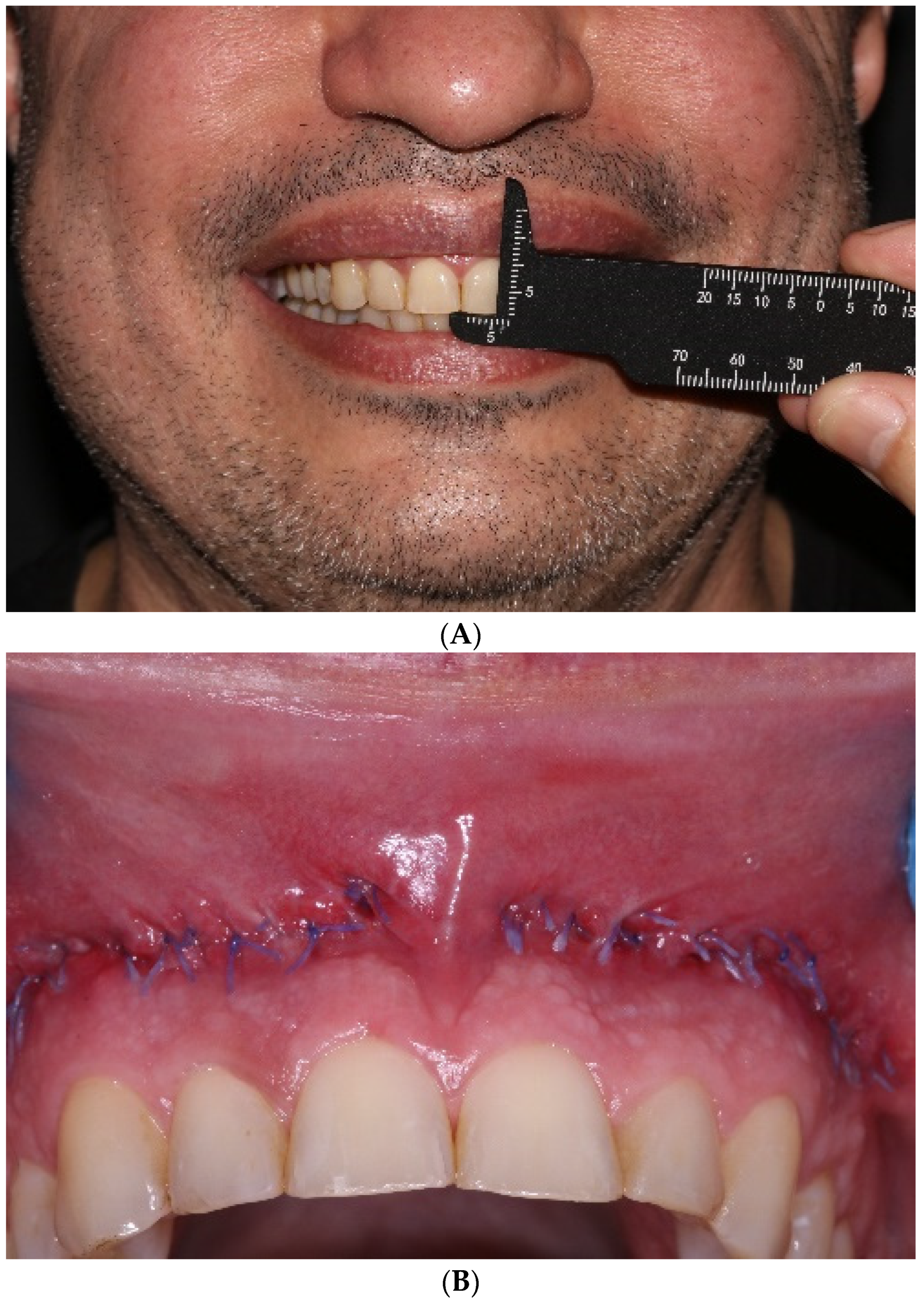 Applsci 14 05580 g006