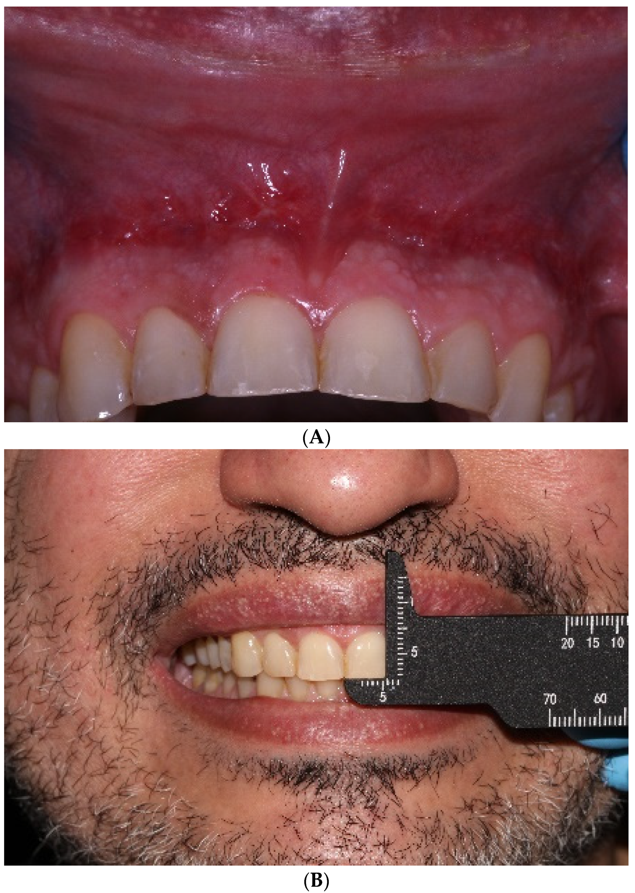 Applsci 14 05580 g007