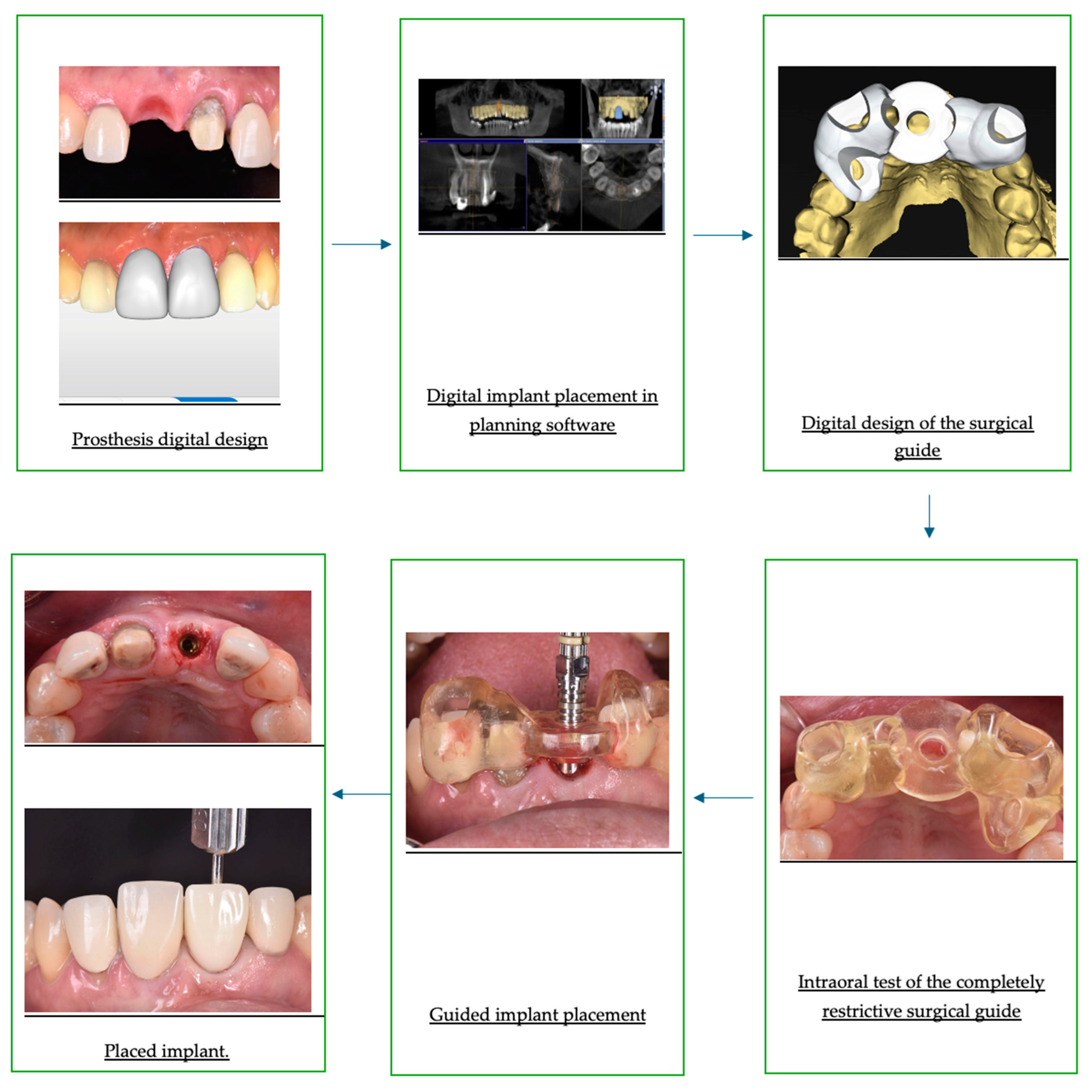 Applsci 14 07422 g001
