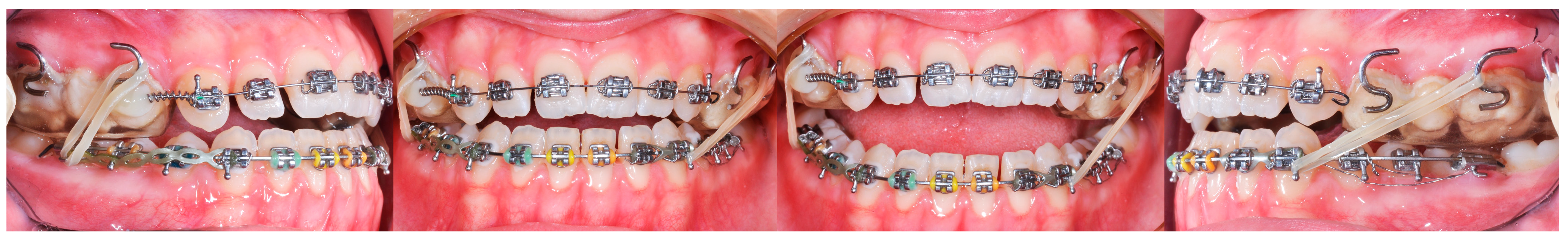 Applsci 14 08095 g011