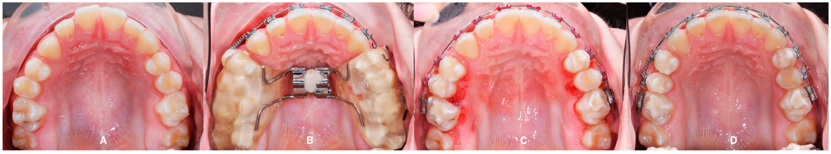 Applsci 14 08095 g017