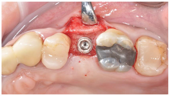 Applsci 14 08756 g003