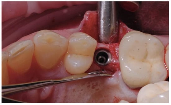 Applsci 14 08756 g004