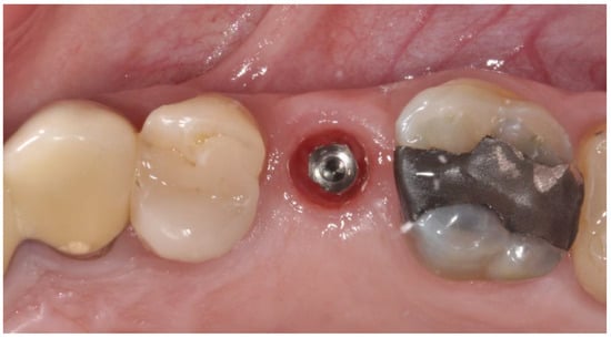 Applsci 14 08756 g005