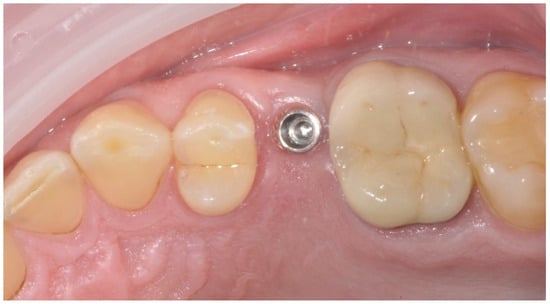 Applsci 14 08756 g006