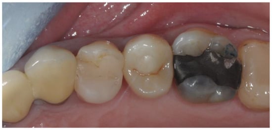 Applsci 14 08756 g010