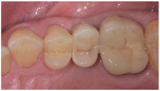 Applsci 14 08756 g011