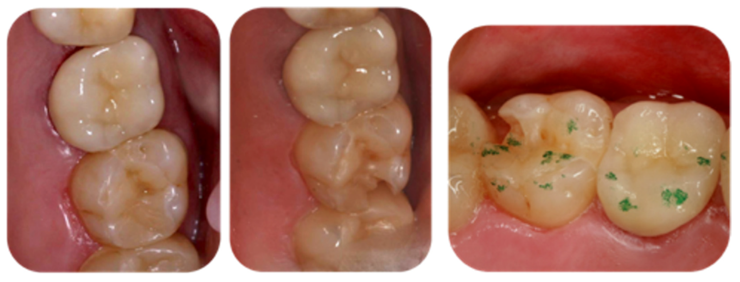 Applsci 14 09964 g003 Applsci 14 09964 g003