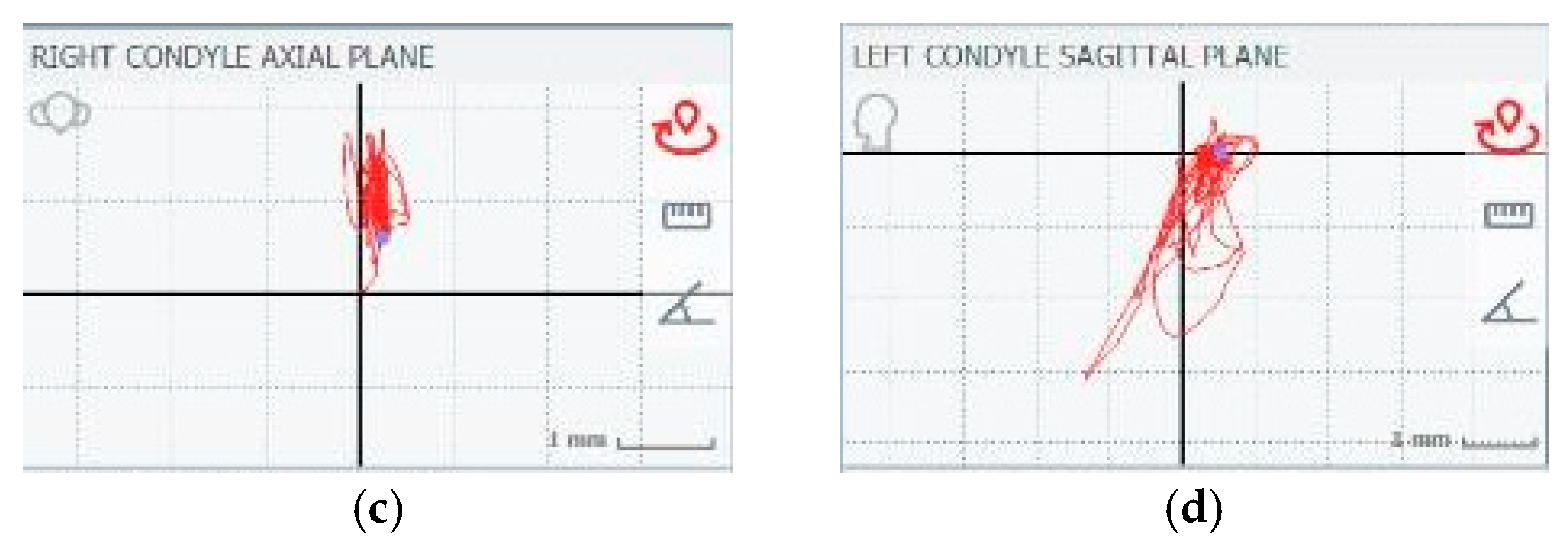 Applsci 14 09996 g004b