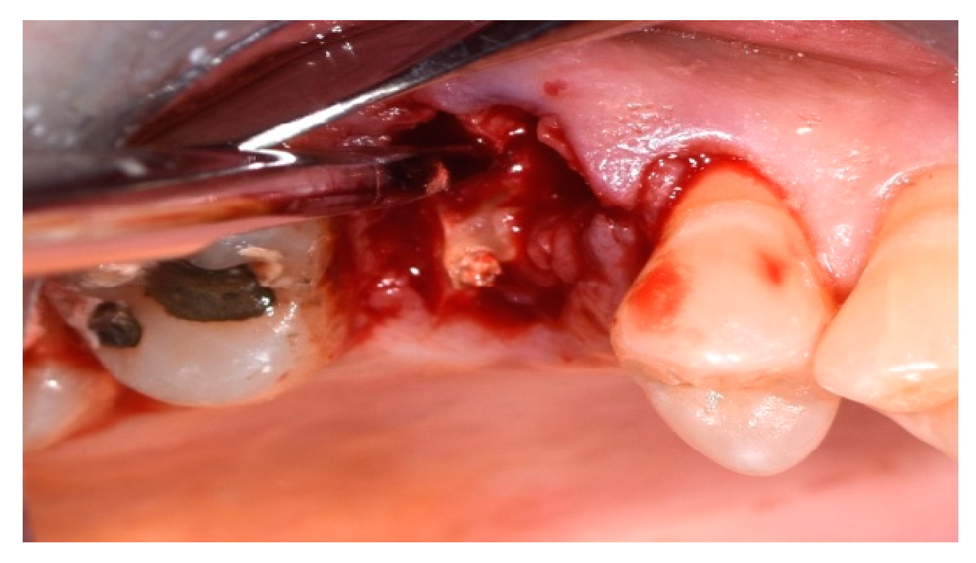 Applsci 14 10623 g006