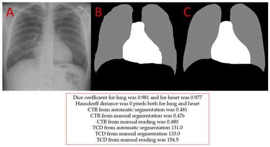 Applsci 14 11605 g0a2