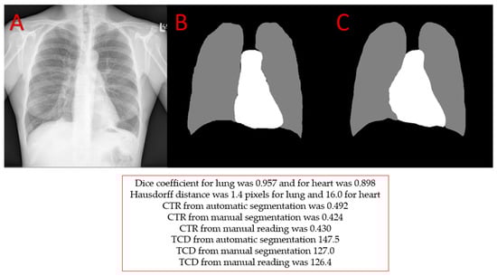 Applsci 14 11605 g0a3