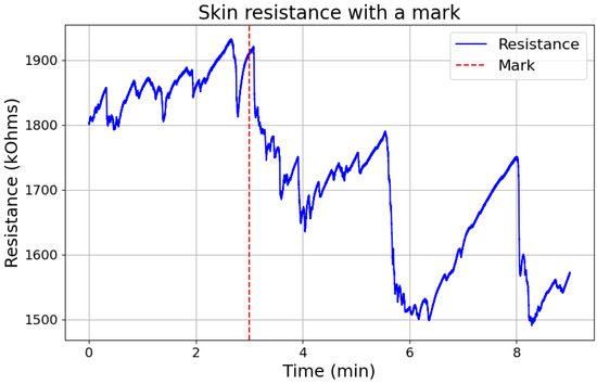 Galvanic Skin Response and Photoplethysmography for Stress Recognition ...