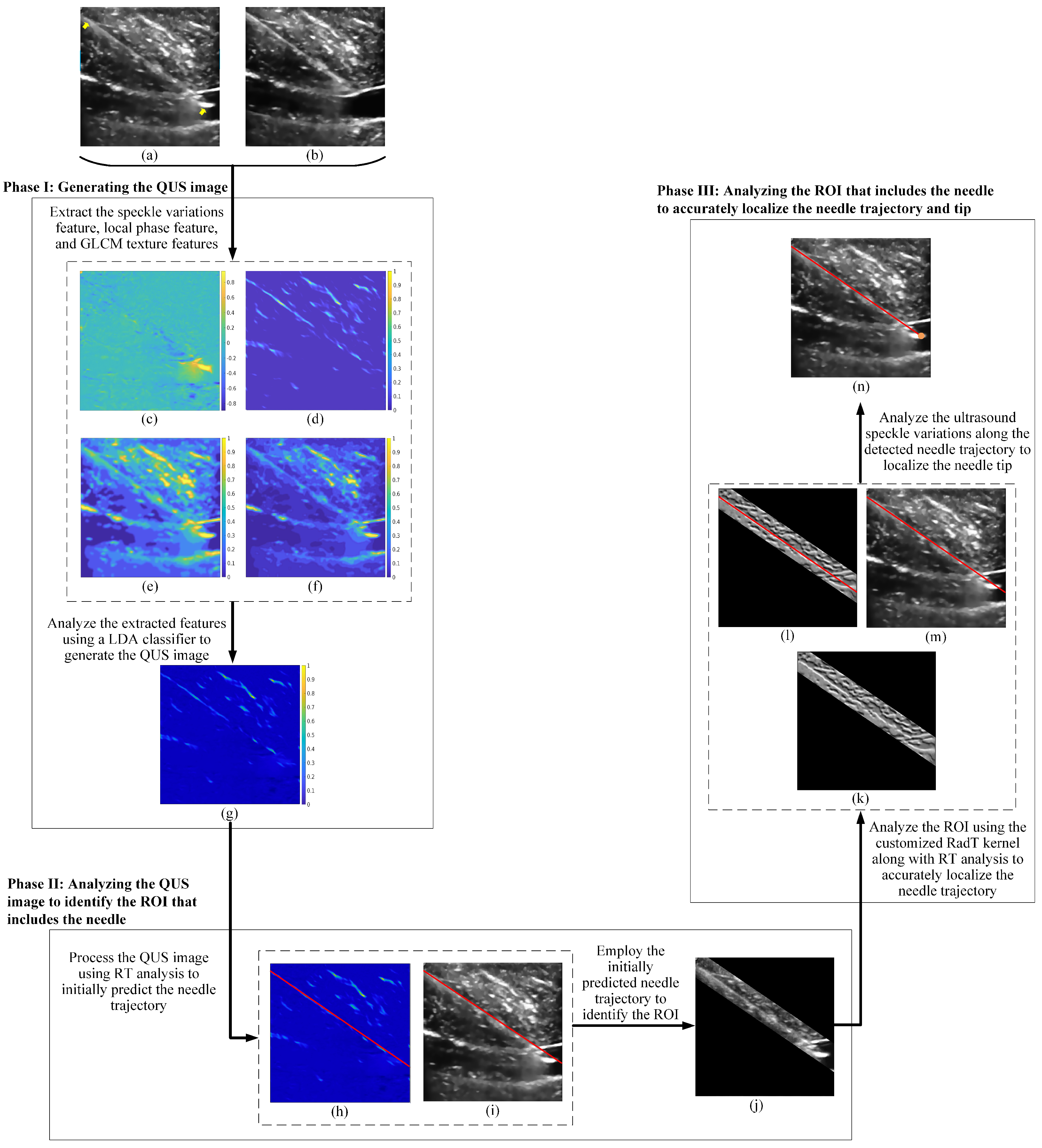 Needle Localization Grid Accurate Needle Localization in the Image Frames of Ultrasound Videos ...