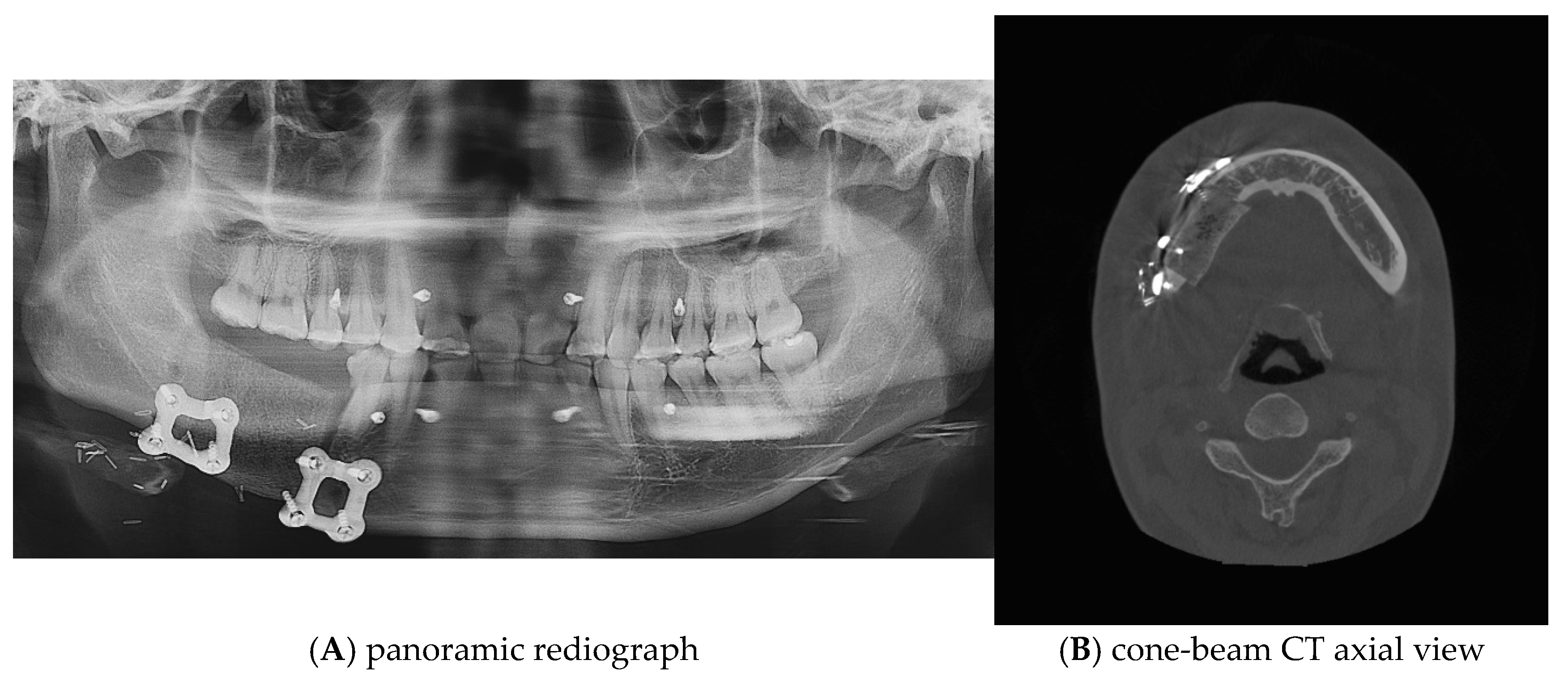 Applsci 15 00687 g011