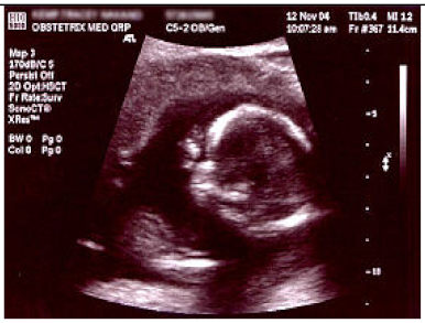 Applsci 15 01796 i007