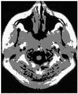 Applsci 15 02355 i002