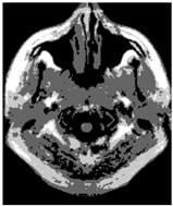 Applsci 15 02355 i004