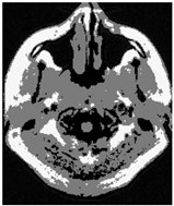 Applsci 15 02355 i008