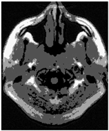 Applsci 15 02355 i009