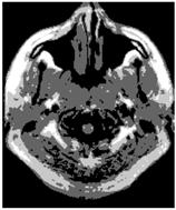 Applsci 15 02355 i010