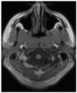 Applsci 15 02355 i013