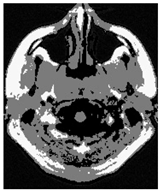 Applsci 15 02355 i014