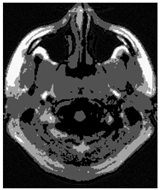 Applsci 15 02355 i015